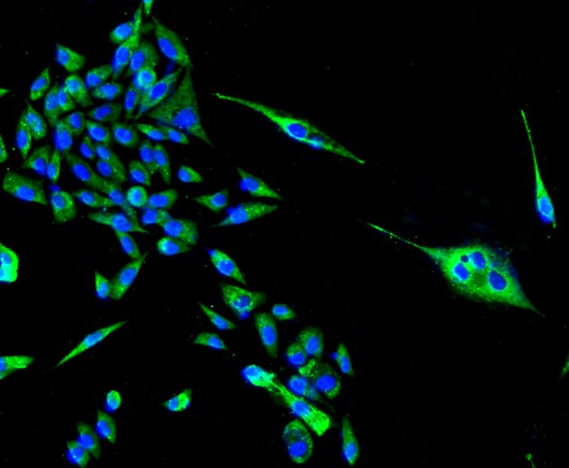 IF(ICC) staining with PBR (1D4) Monoclonal Antibody (bsm-52249R) at 1:100 in PC-3M cells (green). The nuclear counterstain is DAPI (blue). Cells were fixed in paraformaldehyde, permeabilized with 0.25% Triton X100/PBS.
