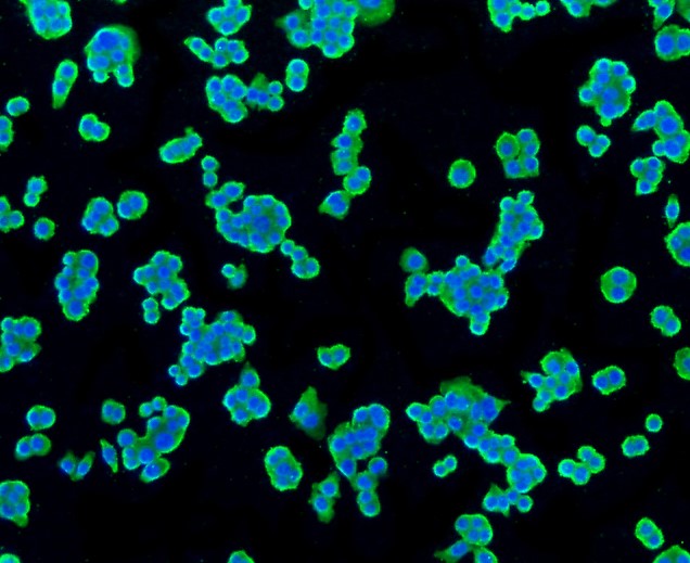 IF(ICC) staining with PBR (1D4) Monoclonal Antibody (bsm-52249R) at 1:100 in SW480 cells (green). The nuclear counterstain is DAPI (blue). Cells were fixed in paraformaldehyde, permeabilized with 0.25% Triton X100/PBS.