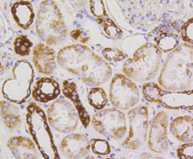 Paraformaldehyde-fixed and paraffin-embedded Human kidney tissue incubated with PBR (1D4) Monoclonal Antibody (bsm-52249R) at 1:100, overnight at 4°C, followed by a conjugated secondary antibody and DAB staining. Counterstained with hematoxylin.
