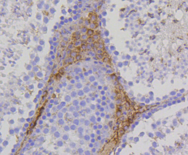 Paraformaldehyde-fixed and paraffin-embedded mouse testis tissue incubated with PBR (1D4) Monoclonal Antibody (bsm-52249R) at 1:100, overnight at 4°C, followed by a conjugated secondary antibody and DAB staining. Counterstained with hematoxylin.