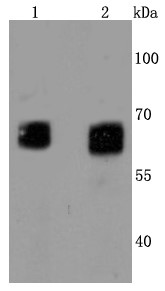 Lane 1: HepG2 cells lysates; Lane 2: 293T brain cells lysates; Probed with GBA (4C2) Monoclonal Antibody (bsm-52907R) at 1:1000 overnight at 4°C followed by a conjugated secondary antibody for 60 minutes at 37°C.