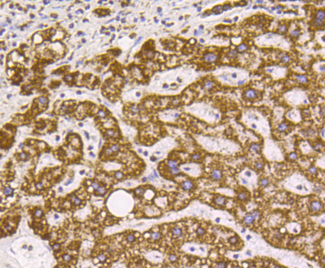 Paraformaldehyde-fixed and paraffin-embedded Human liver tissue incubated with VDAC1 (9A7) Monoclonal Antibody (bsm-52251R) at 1:100, overnight at 4\u00b0C, followed by a conjugated secondary antibody and DAB staining. Counterstained with hematoxylin.