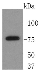 Raji cells Probed with BTK (7H4) Monoclonal Antibody (bsm-52598R) at 1:1000 overnight at 4°C followed by a conjugated secondary antibody for 60 minutes at 37°C. Raji cells Probed with BTK (7H4) Monoclonal Antibody (bsm-52598R) at 1:1000 overnight at 4°C followed by a conjugated secondary antibody for 60 minutes at 37°C.