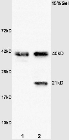L1 rat brain lysates L2 human colon carcinoma lysates probed with Anti- Syndecan 4 Polyclonal Antibody, Unconjugated (bs-2926R) at 1:200 overnight at 4˚C. Followed by conjugation to secondary antibody (bs-0295G-HRP) at 1:3000 for 90 min at 37˚C. Predicted band 21kD.Observed band 21kD, 40kD, may be formed of homo-dimer
