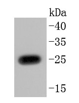 A549 cells lysates probed with PGP9.5 (2A1) Monoclonal Antibody (bsm-52897R) at 1:1000 overnight at 4\u00b0C followed by a conjugated secondary antibody for 60 minutes at 37\u00b0C.