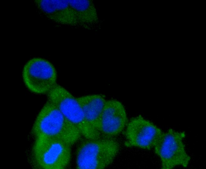 IF(ICC) staining with Alkaline Phosphatase (1G9) Monoclonal Antibody (bsm-52252R) at 1:100 in HeLa cells (green). The nuclear counterstain is DAPI (blue). Cells were fixed in paraformaldehyde, permeabilized with 0.25% Triton X100/PBS.