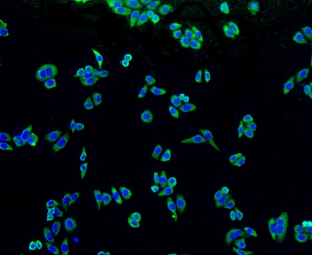 IF(ICC) staining with Alkaline Phosphatase (1G9) Monoclonal Antibody (bsm-52252R) at 1:100 in HepG2 cells (green). The nuclear counterstain is DAPI (blue). Cells were fixed in paraformaldehyde, permeabilized with 0.25% Triton X100/PBS.