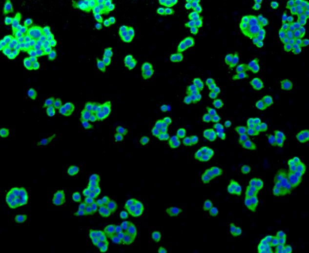 IF(ICC) staining with Alkaline Phosphatase (1G9) Monoclonal Antibody (bsm-52252R) at 1:100 in SW480 cells (green). The nuclear counterstain is DAPI (blue). Cells were fixed in paraformaldehyde, permeabilized with 0.25% Triton X100/PBS.