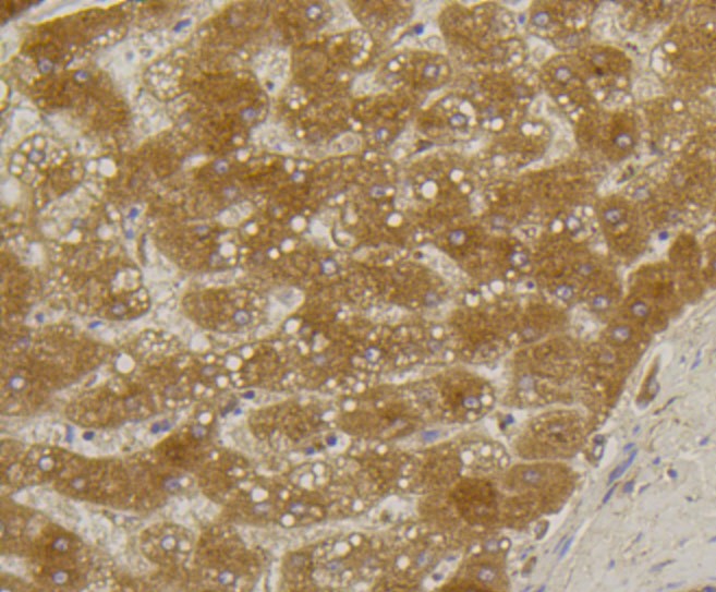 Paraformaldehyde-fixed and paraffin-embedded Human liver tissue incubated with Alkaline Phosphatase (1G9) Monoclonal Antibody (bsm-52252R) at 1:100, overnight at 4°C, followed by a conjugated secondary antibody and DAB staining. Counterstained with hematoxylin.
