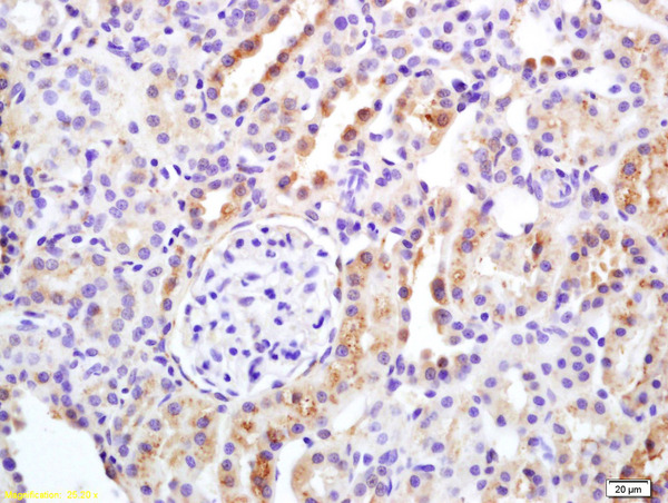 Formalin-fixed and paraffin embedded rat kidney labeled with Rabbit Anti APAF1 Polyclonal Antibody, Unconjugated (bs-0058R) at 1:200 followed by conjugation to the secondary antibody and DAB staining
