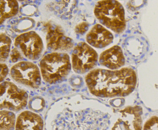 Paraformaldehyde-fixed and paraffin-embedded Human kidney tissue incubated with Alkaline Phosphatase (1G9) Monoclonal Antibody (bsm-52252R) at 1:100, overnight at 4°C, followed by a conjugated secondary antibody and DAB staining. Counterstained with hematoxylin.