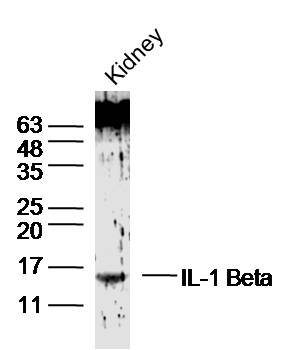 Mouse Kidney lysates probed with IL-1 Beta Polyclonal Antibody, Unconjugated (bs-20449R) at 1:300 dilution and 4˚C overnight incubation. Followed by conjugated secondary antibody incubation at 1:10000 for 60 min at 37˚C. Protein band represents active mature form.