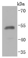 HA-tag recombinant protein lysates probed with HA-Tag (HRP conjugated) (8C9)Monoclonal Antibody (bsm-52887R) at 1:10000 overnight at 4°C followed by a conjugated secondary antibody for 60 minutes at 37°C.