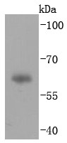 Human plasma lysates probed with IgA (2C8) Monoclonal Antibody (bsm-52885R) at 1:1000 overnight at 4°C followed by a conjugated secondary antibody for 60 minutes at 37°C.
