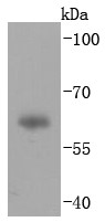 Human plasma lysates probed with IgA (2C8) Monoclonal Antibody (bsm-52885R) at 1:1000 overnight at 4°C followed by a conjugated secondary antibody for 60 minutes at 37°C. Human plasma lysates probed with IgA (2C8) Monoclonal Antibody (bsm-52885R) at 1:1000 overnight at 4°C followed by a conjugated secondary antibody for 60 minutes at 37°C.