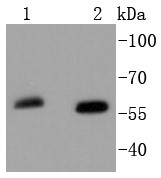 Lane 1: Mouse brain; Lane 2: HepG2 Cells; Probed with SOX10 (9A44) Monoclonal Antibody (bsm-52642R) at 1:1000 overnight at 4°C followed by a conjugated secondary antibody for 60 minutes at 37°C. Lane 1: Mouse brain; Lane 2: HepG2 Cells; Probed with SOX10 (9A44) Monoclonal Antibody (bsm-52642R) at 1:1000 overnight at 4°C followed by a conjugated secondary antibody for 60 minutes at 37°C.