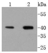Lane 1: HUVEC Cells; Lane 2: Rat brain; Probed with Delta Opioid Receptor (8A1) Monoclonal Antibody (bsm-52645R) at 1:1000 overnight at 4°C followed by a conjugated secondary antibody for 60 minutes at 37°C.
