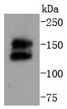 MCF-7 cells probed with Ret (4C3) Monoclonal Antibody (bsm-52650R) at 1:1000 overnight at 4°C followed by a conjugated secondary antibody for 60 minutes at 37°C.