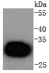 Hela cells Probed with Cdk4 (6A4) Monoclonal Antibody (bsm-52651R) at 1:1000 overnight at 4°C followed by a conjugated secondary antibody for 60 minutes at 37°C.