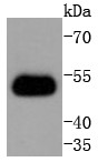 Hela cells probed with TRAF2 (9C2) Monoclonal Antibody (bsm-52675R) at 1:1000 overnight at 4°C followed by a conjugated secondary antibody for 60 minutes at 37°C.