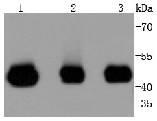 Lane 1: Jurkat Cells; Lane 2: Hela Cells; Lane 3: 293T Cells; Probed with MEK2 (2C1) Monoclonal Antibody (bsm-52684R) at 1:1000 overnight at 4°C followed by a conjugated secondary antibody for 60 minutes at 37°C.