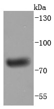 Human plasma lysates probed with Human IgM (4C2) Monoclonal Antibody (bsm-52860R) at 1:1000 overnight at 4°C followed by a conjugated secondary antibody for 60 minutes at 37°C.
