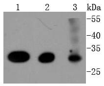 Lane 1: Hela Cells; Lane 2: MCF-7 Cells; Lane 3: K562 Cells; Probed with Cdk4 (7G7) Monoclonal Antibody (bsm-52659R) at 1:1000 overnight at 4°C followed by a conjugated secondary antibody for 60 minutes at 37°C.