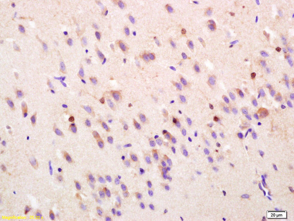 Formalin-fixed and paraffin embedded rat brain labeled with Rabbit Anti FGF1/AFGF Polyclonal Antibody, Unconjugated (bs-0229R) at 1:200 followed by conjugation to the secondary antibody and DAB staining