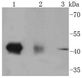 Lane 1: NIH/3T3 lysates; Lane 2: Human brain lysates; Line 3: 293 lysates ;Probed with p38 MAPK (10B7)Monoclonal Antibody (bsm-52844R) at 1:1000 overnight at 4°C followed by a conjugated secondary antibody for 60 minutes at 37°C.