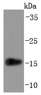 Human lung lysates probed with Prealbumin (2C8) Monoclonal Antibody (bsm-52823R) at 1:1000 overnight at 4°C followed by a conjugated secondary antibody for 60 minutes at 37°C. Human lung lysates probed with Prealbumin (2C8) Monoclonal Antibody (bsm-52823R) at 1:1000 overnight at 4°C followed by a conjugated secondary antibody for 60 minutes at 37°C.