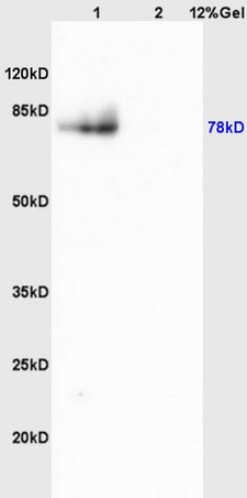 L1 mouse brain lysates L2 mouse heart lysates probed with Anti MMP9 Polyclonal Antibody, Unconjugated (bs-4593R) at 1:200 overnight at 4˚C. Followed by conjugation to secondary antibody (bs-0295G-HRP) at 1:3000 for 90 min at 37˚C. Predicted band 78kD. Observed band size: 78kD.
