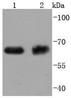Lane 1: HepG2 lysates; Lane 2: Human placenta lysates; Probed with ABCG2 (4C4) Monoclonal Antibody (bsm-52821R) at 1:1000 overnight at 4°C followed by a conjugated secondary antibody for 60 minutes at 37°C.
