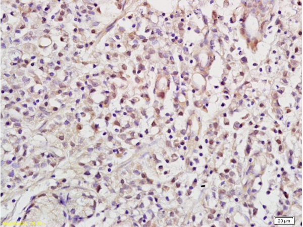 Formalin-fixed and paraffin embedded human gastric tissue labeled with Anti NRSF/REST Polyclonal Antibody,Unconjugated (bs-2590R) at 1:200 followed by conjugation to the secondary antibody and DAB staining.
