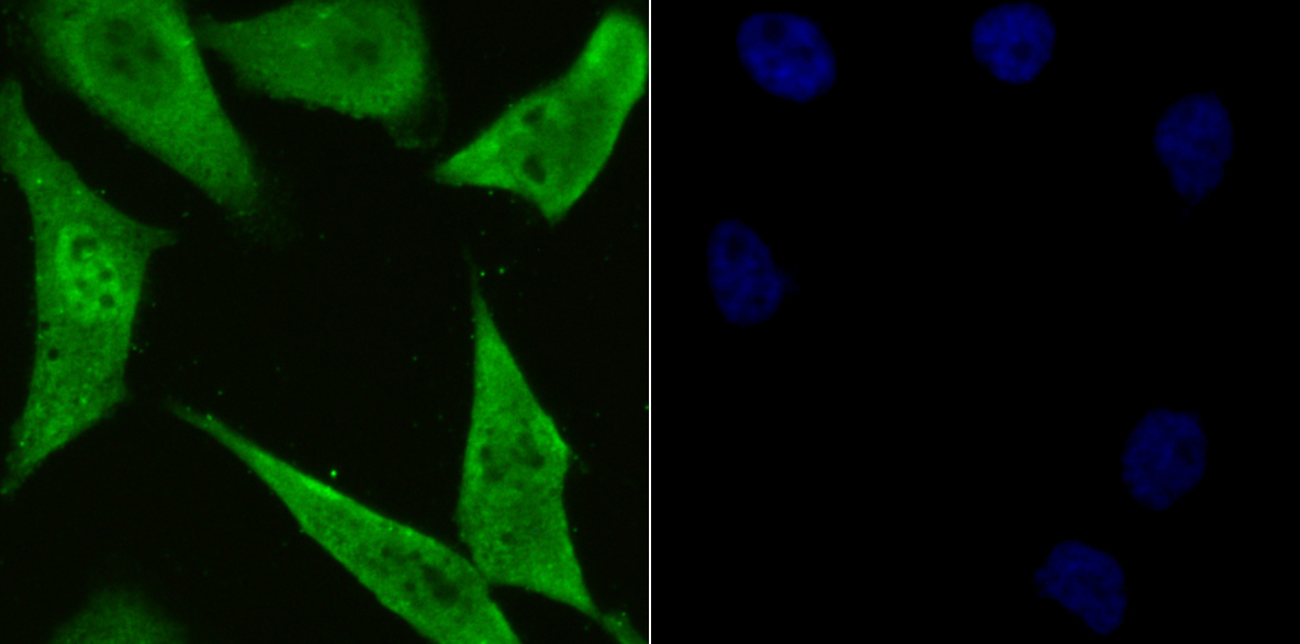 IF(ICC) staining with PSMA1 (10A2) Monoclonal Antibody (bsm-54170R) at 1:300 in PC-3M cells (green). The nuclear counterstain is DAPI (blue). Cells were fixed in paraformaldehyde, permeabilized with 0.25% Triton X100/PBS.