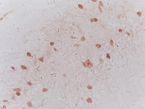 Formalin-fixed and paraffin embedded mouse brain labeled with Anti-NRSF/REST Polyclonal Antibody, Unconjugated (bs-2590R) at 1:200 followed by conjugation to the secondary antibody and DAB staining.
