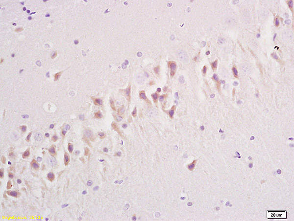 Formalin-fixed and paraffin embedded rat brain tissue labeled with Anti GRM1 Polyclonal Antibody,Unconjugated (bs-1803R) at 1:200 followed by conjugation to the secondary antibody and DAB staining.