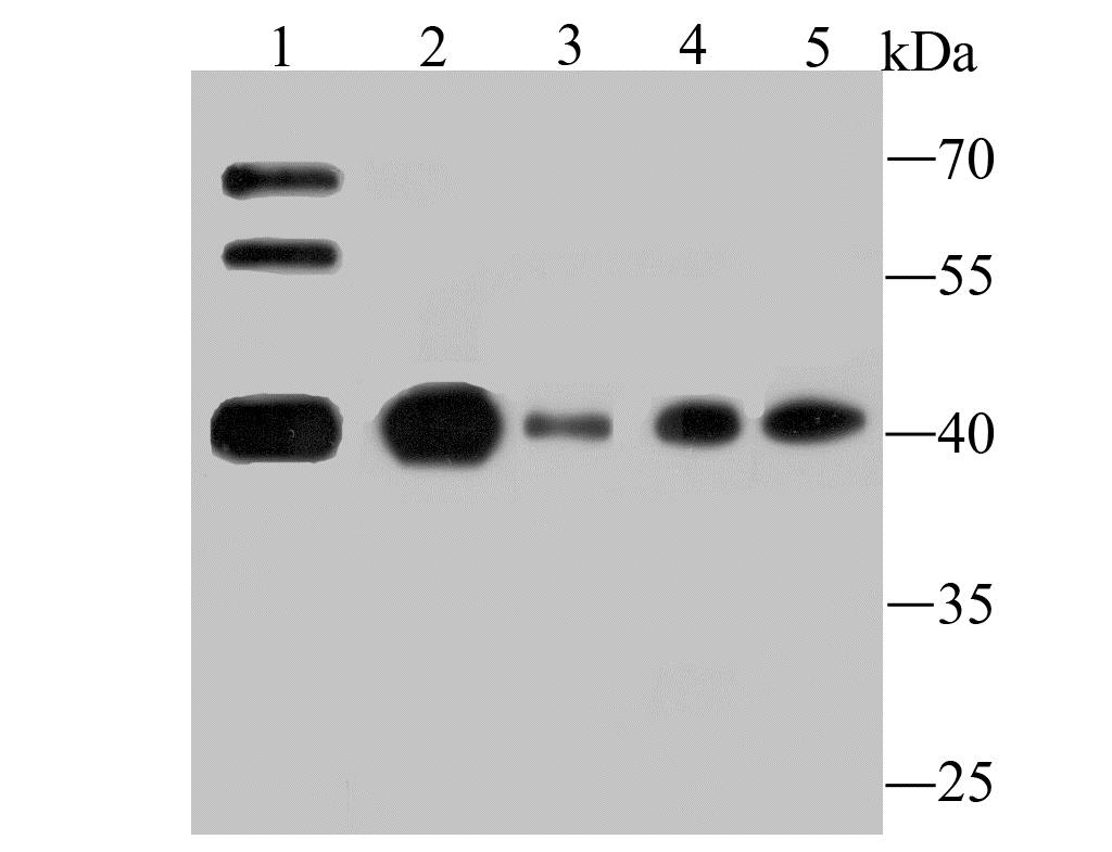 Lane 1: Mouse Testis; Lane 2: K562 Cells; Lane 3: HL-60 Cells; Lane 4: Hela Cells; Lane 5: Jurkat Cells; Probed with ATG3 (9C8) Monoclonal Antibody (bsm-54179R) at 1:500 overnight at 4°C followed by a conjugated secondary antibody for 60 minutes at 37°C.