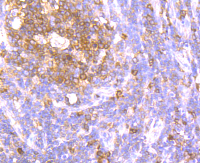 Paraformaldehyde-fixed and paraffin-embedded Human Tonsil tissue incubated with ATG3 (9C8) Monoclonal Antibody (bsm-54179R) at 1:100, overnight at 4°C, followed by a conjugated secondary antibody and DAB staining. Counterstained with hematoxylin.