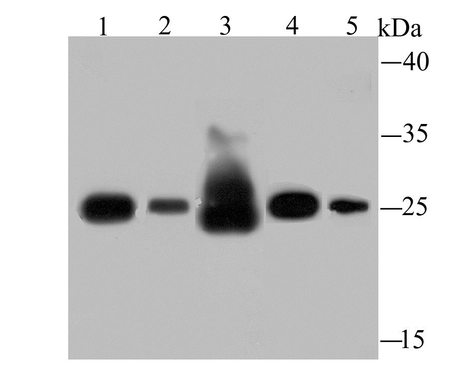 Lane 1: Human Liver; Lane 2: Rat Spleen; Lane 3: Rat Liver; Lane 4: Mouse Spleen; lane 5: HepG2 Cells; Probed with SDHB (4C7) Monoclonal Antibody (bsm-54180R) at 1:500 overnight at 4°C followed by a conjugated secondary antibody for 60 minutes at 37°C.
