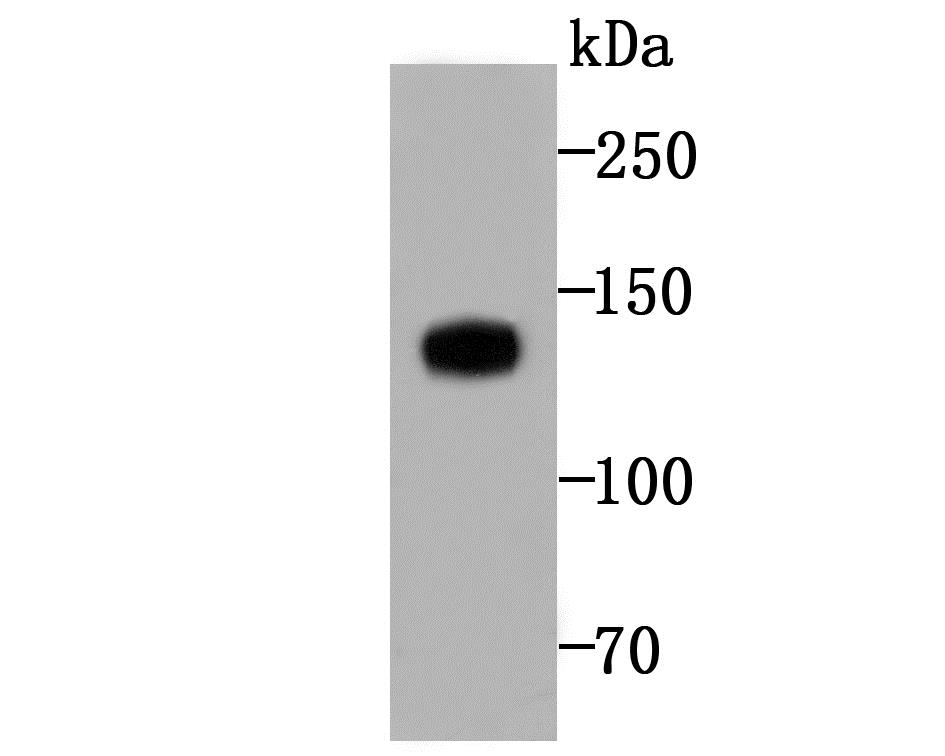 Lane 1: Skin Tissue; Probed with Involucrin (7C8) Monoclonal Antibody (bsm-54182R) at 1:1000 overnight at 4°C followed by a conjugated secondary antibody for 60 minutes at 37°C.