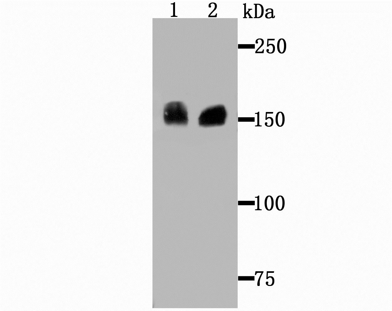 Lane 1: Hela Cells; Lane 2: SiHa Cells; Probed with Drosha (5C9) Monoclonal Antibody (bsm-54184R) at 1:1000 overnight at 4°C followed by a conjugated secondary antibody for 60 minutes at 37°C.