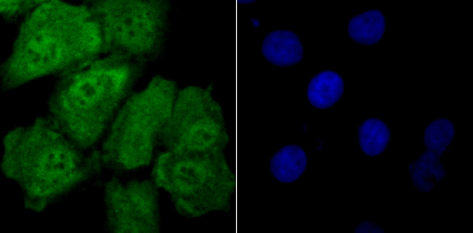 IF(ICC) staining with Drosha (5C9) Monoclonal Antibody (bsm-54184R) at 1:100 in A549 cells (green). The nuclear counterstain is DAPI (blue). Cells were fixed in paraformaldehyde, permeabilized with 0.25% Triton X100/PBS.