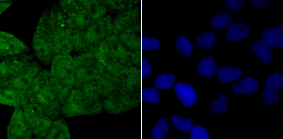 IF(ICC) staining with Drosha (5C9) Monoclonal Antibody (bsm-54184R) at 1:100 in Hela cells (green). The nuclear counterstain is DAPI (blue). Cells were fixed in paraformaldehyde, permeabilized with 0.25% Triton X100/PBS.