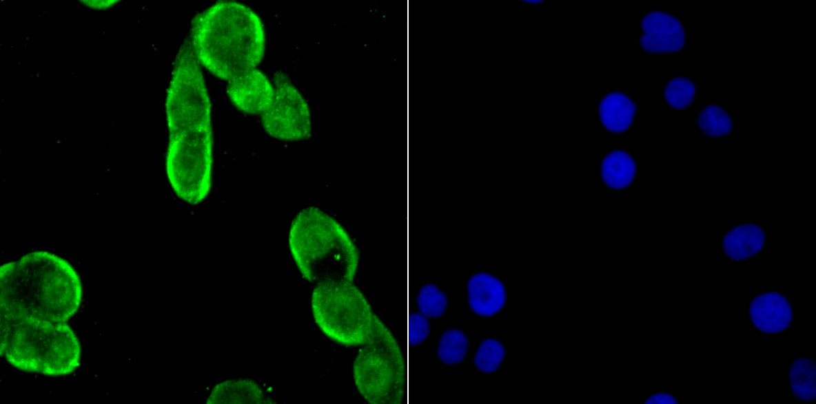 IF(ICC) staining with Drosha (5C9) Monoclonal Antibody (bsm-54184R) at 1:100 in LOVO cells (green). The nuclear counterstain is DAPI (blue). Cells were fixed in paraformaldehyde, permeabilized with 0.25% Triton X100/PBS.