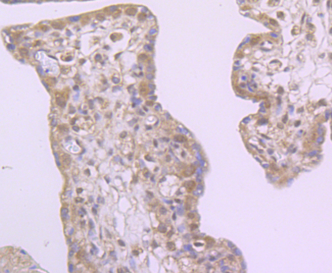 Paraformaldehyde-fixed and paraffin-embedded Human Placenta tissue incubated with Drosha (5C9) Monoclonal Antibody (bsm-54184R) at 1:100, overnight at 4°C, followed by a conjugated secondary antibody and DAB staining. Counterstained with hematoxylin.