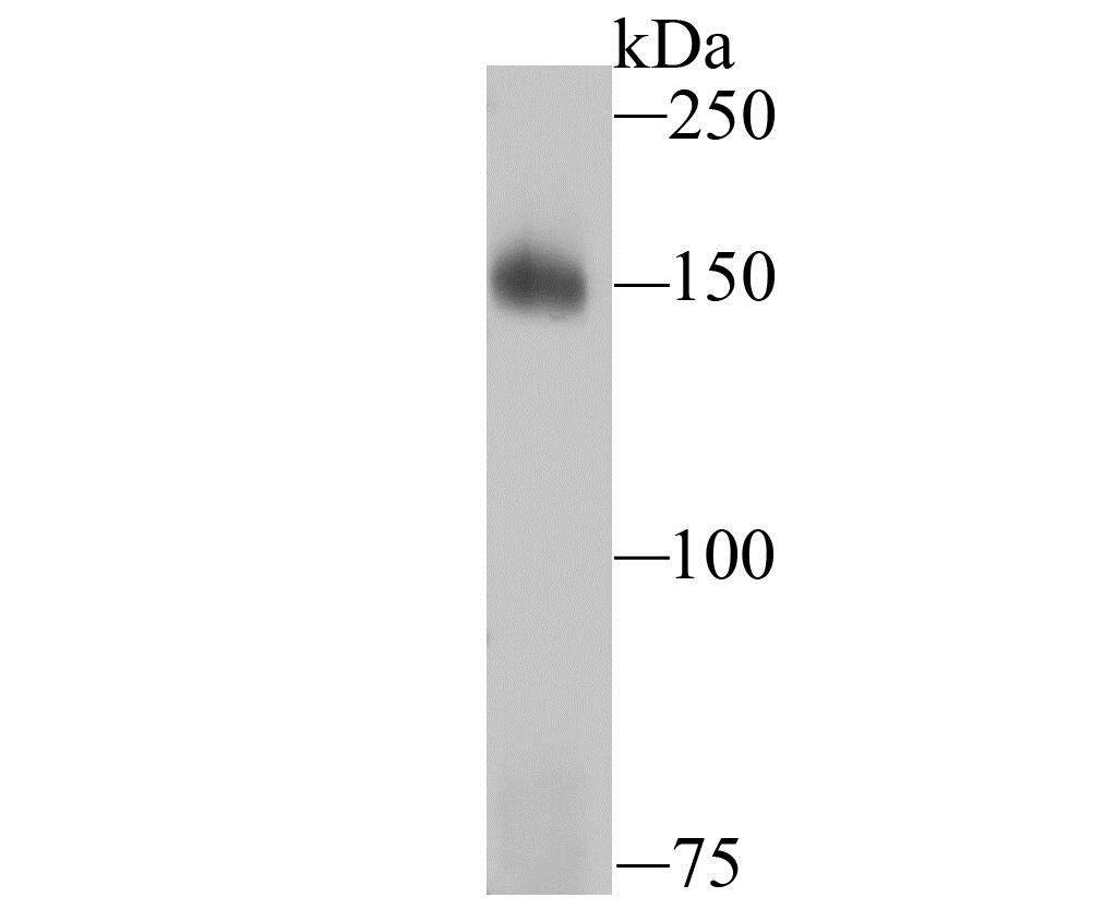 Lane 1: K562 Cells; Probed with Drosha (5C9) Monoclonal Antibody (bsm-54184R) at 1:1000 overnight at 4°C followed by a conjugated secondary antibody for 60 minutes at 37°C.