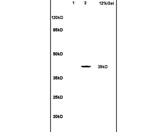 Lane 1: rat brain lysates Lane 2: rat heart lysates probed with Anti LBT4-R1 Polyclonal Antibody, Unconjugated (bs-2654R) at 1:200 in 4˚C. Followed by conjugation to secondary antibody (bs-0295G-HRP) at 1:3000 90min in 37˚C. Predicted band 39kD. Observed band size: 39kD.