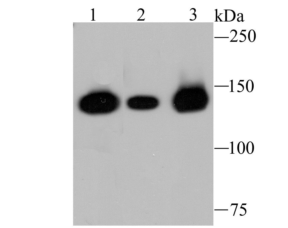 Lane 1: K562 Cells; Lane 2: HepG2 Cells; Lane 3: Raji Cells; Probed with HDAC9 (2C9) Monoclonal Antibody (bsm-54186R) at 1:1000 overnight at 4°C followed by a conjugated secondary antibody for 60 minutes at 37°C.