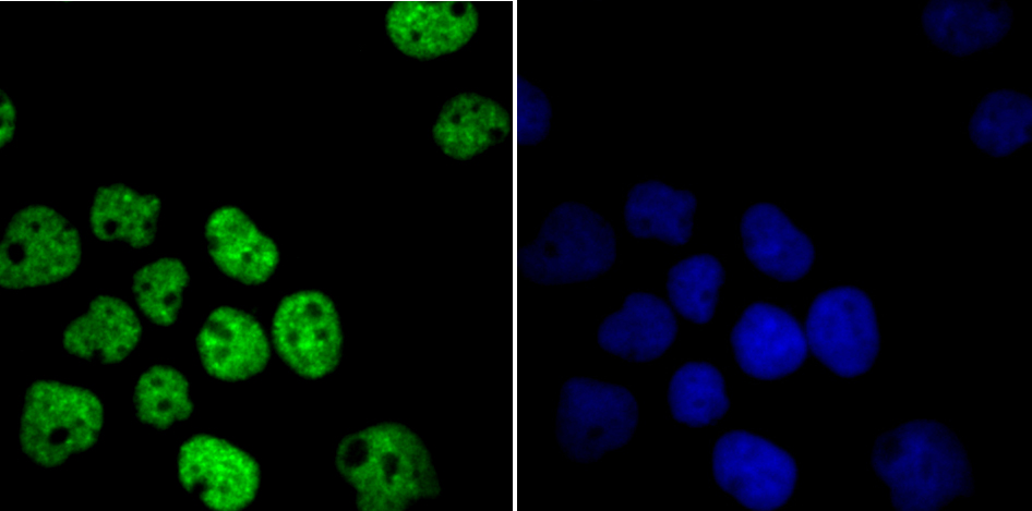 IF(ICC) staining with HDAC9 (2C9) Monoclonal Antibody (bsm-54186R) at 1:100 in A431 cells (green). The nuclear counterstain is DAPI (blue). Cells were fixed in paraformaldehyde, permeabilized with 0.25% Triton X100/PBS.