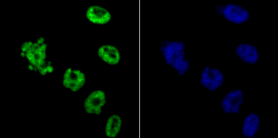 IF(ICC) staining with HDAC9 (2C9) Monoclonal Antibody (bsm-54186R) at 1:100 in PC-3M cells (green). The nuclear counterstain is DAPI (blue). Cells were fixed in paraformaldehyde, permeabilized with 0.25% Triton X100/PBS.